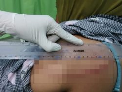 Pulang Ambil Charger, Cucu di Sumbawa Temukan Kakek Nenek Tewas Bersimbah Darah
