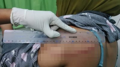 Pulang Ambil Charger, Cucu di Sumbawa Temukan Kakek Nenek Tewas Bersimbah Darah